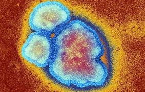 International Measles Tracker